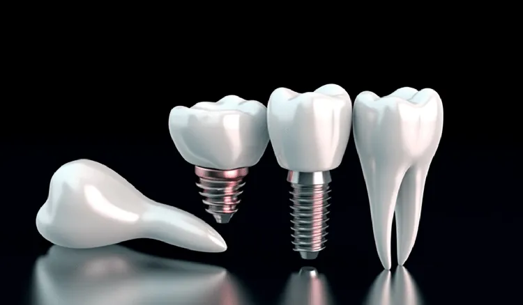 A Guide to Free Dental Implant Programs for Low-Income Individuals