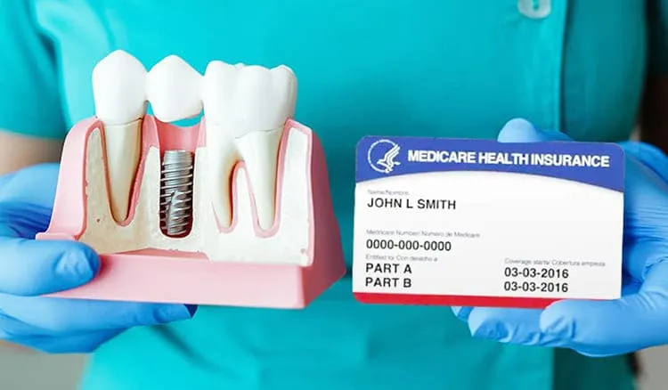 How to Get Dental Implants Covered by Medicare