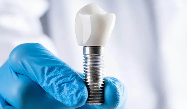 Medicare Dental Implant Costs